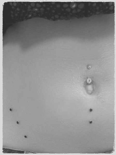 Microdermal 5er Bauch Kombination 